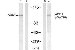 Western blot analysis of extract from HT-29 cells untreated or treated with Doxorubicin (1mM, 30min), using ADD1 (Ab-726) antibody (E021189, Lane 1 and 2) and ADD1 (Phospho- Ser726) antibody (E011182, Lane 3 and 4). (alpha Adducin antibody  (pSer726))