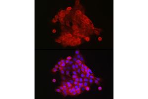 Immunofluorescence analysis of  cells using S100 Rabbit pAb (842) at dilution of 1:150 (40x lens). (S100A9 antibody  (AA 1-114))