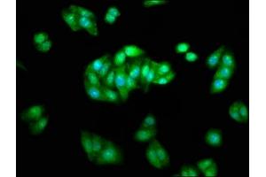 Immunofluorescence staining of HepG2 cells with ABIN7145444 at 1:233, counter-stained with DAPI. (beta Arrestin 1 antibody  (AA 1-260))
