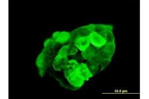 Immunofluorescence (IF) image for anti-GTPase Activating Protein (SH3 Domain) Binding Protein 1 (G3BP1) (AA 1-466) antibody (ABIN523522)