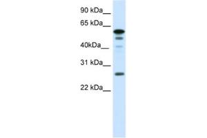 Western Blotting (WB) image for anti-Forkhead Box D1 (FOXD1) antibody (ABIN2461434) (FOXD1 antibody)