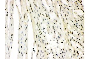Anti- SLUG Picoband antibody,IHC(P) IHC(P): Rat Cardiac Muscle Tissue (SLUG antibody  (Middle Region))