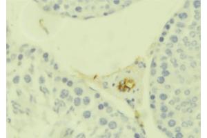 ABIN6273663 at 1/100 staining Mouse testis tissue by IHC-P. (IL1RL1 antibody  (Internal Region))