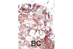 Immunohistochemistry (IHC) image for anti-Ubiquilin 1 (UBQLN1) antibody (ABIN3001493)