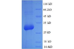SDS-PAGE (SDS) image for Osteocalcin (BGLAP) (AA 50-99) protein (GST tag) (ABIN5709135) (Osteocalcin Protein (BGLAP) (AA 50-99) (GST tag))