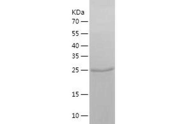 MYCN Protein (AA 282-464) (His tag)