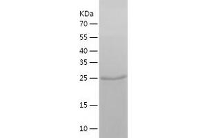 Western Blotting (WB) image for N-Myc Proto-Oncogene Protein (MYCN) (AA 282-464) protein (His tag) (ABIN7124095) (MYCN Protein (AA 282-464) (His tag))