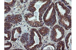 Image no. 5 for anti-Ubiquitin-Conjugating Enzyme E2, J1, U (UBE2J1) antibody (ABIN1501638)