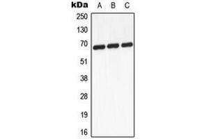 Western blot analysis of GCKR expression in A431 (A), mouse heart (B), PC12 (C) whole cell lysates. (GCKR antibody  (Center))