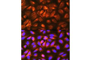 anti-Low Density Lipoprotein Receptor-Related Protein Associated Protein 1 (LRPAP1) (AA 35-357) antibody