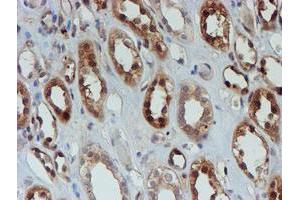 Immunohistochemical staining of paraffin-embedded Human Kidney tissue using anti-SAT2 mouse monoclonal antibody. (SAT2 antibody)