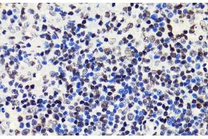 Immunohistochemistry of paraffin-embedded Rat spleen using Acetyl-Histone H2B-K5 Polyclonal Antibody at dilution of 1:100 (40x lens). (Histone H2B antibody  (acLys5))