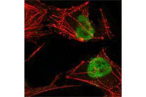 Confocal immunofluorescence analysis of Hela cells using MSH2 mouse mAb (green), showing nuclear localization. (MSH2 antibody)