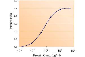 Acetyl-CoA Carboxylase beta antibody  (Internal Region)