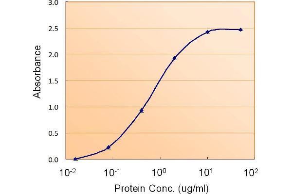 Acetyl-CoA Carboxylase beta antibody  (Internal Region)