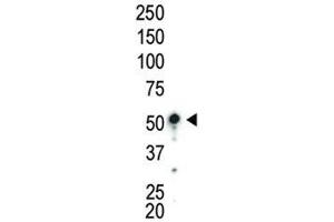 Western blot analysis of AMPK antibody and mouse liver lysate (PRKAA1 antibody  (AA 479-510))