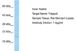Host: Rabbit Target Name: TRAPPC2 Sample Tissue: Rat Stomach Antibody Dilution: 1ug/ml
