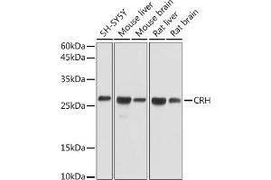 Western blot analysis of extracts of various cell lines, using CRH antibody (ABIN3021479, ABIN3021480, ABIN3021481 and ABIN6215115) at 1:1000 dilution. (CRH antibody  (AA 25-194))