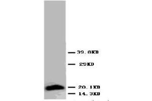 anti-Myosin, Slow Muscle antibody (Magnetic Particles)