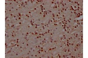 IHC image of ABIN7127607 diluted at 1:100 and staining in paraffin-embedded human brain tissue performed on a Leica BondTM system. (Recombinant MAD2L2 antibody)