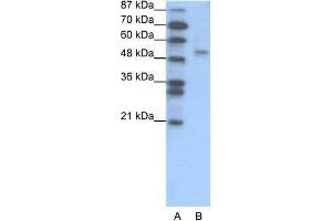 Human Jurkat; WB Suggested Anti-FOXD2 Antibody Titration: 1. (FOXD2 antibody  (N-Term))