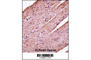 Mouse Pdk3 Antibody immunohistochemistry analysis in formalin fixed and paraffin embedded mouse heart tissue followed by peroxidase conjugation of the secondary antibody and DAB staining. (PDK3 antibody  (C-Term))