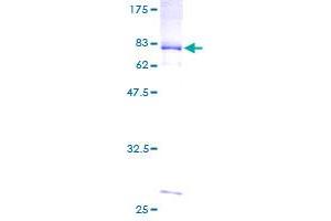 Image no. 1 for Sialophorin (SPN) (AA 1-400) protein (GST tag) (ABIN1321208) (CD43 Protein (AA 1-400) (GST tag))
