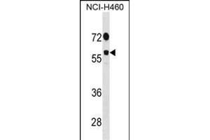 DDX19B Antibody (N-term) (ABIN1881254 and ABIN2838987) western blot analysis in NCI- cell line lysates (35 μg/lane).