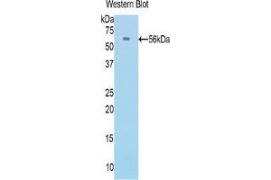 Detection of Recombinant PROC, Rat using Polyclonal Antibody to Protein C (PROC) (PROC antibody  (AA 186-437))