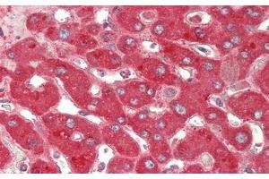 Detection of CP in Human Liver Tissue using Polyclonal Antibody to Ceruloplasmin (CP) (Ceruloplasmin antibody  (AA 789-1065))