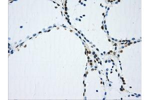 Immunohistochemical staining of paraffin-embedded colon tissue using anti-IFIT3mouse monoclonal antibody. (IFIT3 antibody)