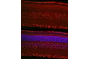 Immunofluorescence analysis of rat retina cells using RPGR Rabbit pAb (ABIN3015609, ABIN3015610, ABIN3015611, ABIN1682567 and ABIN6218971) at dilution of 1:50 (40x lens).