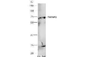 Mouse liver lysates probed with Rabbit Anti-TNFAIP2 Polyclonal Antibody, Unconjugated  at 1:5000 for 90 min at 37˚C. (TNFAIP2 antibody  (AA 551-654))