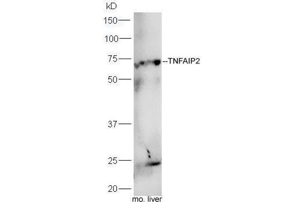 TNFAIP2 antibody  (AA 551-654)
