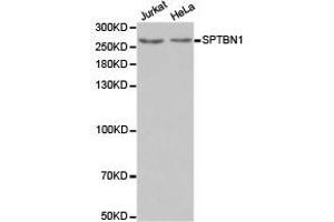 Western Blotting (WB) image for anti-Spectrin Beta, Non-Erythrocytic 1 (SPTBN1) antibody (ABIN1874930) (SPTBN1 antibody)