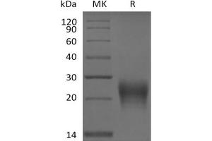 Fas Ligand (TNF Superfamily, Member 6) (FASL) protein (His tag)