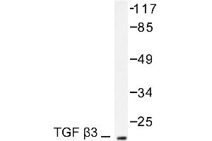 Image no. 1 for anti-Transforming Growth Factor, beta 3 (TGFB3) antibody (ABIN271851) (TGFB3 antibody)