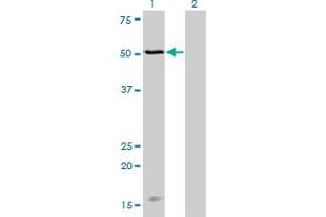 Western Blot analysis of MAGOH expression in transfected 293T cell line by MAGOH monoclonal antibody (M02), clone 4H8. (MAGOH antibody  (AA 1-110))