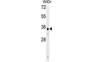 WDR5B Antibody (N-term) western blot analysis in WiDr cell line lysates (35 µg/lane). (WDR5B antibody  (N-Term))