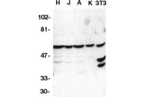 Image no. 1 for anti-Caspase 10, Apoptosis-Related Cysteine Peptidase (CASP10) (AA 505-521) antibody (ABIN201420) (Caspase 10 antibody  (AA 505-521))