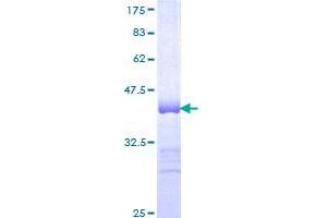 Myomesin 3 (MYOM3) (AA 854-955) protein (GST tag)