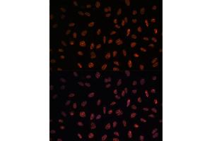 Immunofluorescence (IF) image for anti-Matrin 3 (MATR3) (AA 747-847) antibody (ABIN7268415)