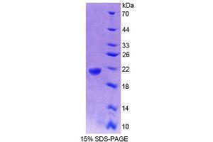 SDS-PAGE (SDS) image for Glucosidase, Alpha, Acid (GAA) (AA 70-225) protein (His tag) (ABIN6238655) (GAA Protein (AA 70-225) (His tag))