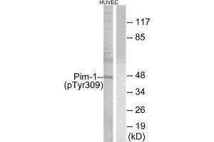 Western Blotting (WB) image for anti-Pim-1 Oncogene (PIM1) (pTyr309) antibody (ABIN1847325) (PIM1 antibody  (pTyr309))