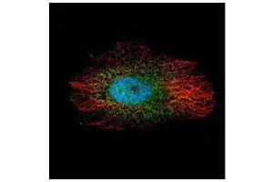 ICC/IF Image Confocal immunofluorescence analysis (Olympus FV10i) of paraformaldehyde-fixed HeLa, using LIM kinase 2, antibody (Green) at 1:500 dilution. (LIMK2 antibody)