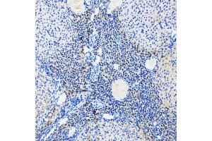 Immunohistochemistry of paraffin-embedded rat ovary using MYOG antibody (ABIN5974015) at dilution of 1/100 (20x lens). (Myogenin antibody)