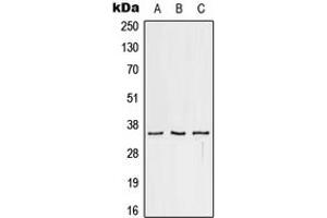 Western Blotting (WB) image for anti-Fc Fragment of IgG, Low Affinity IIc, Receptor For (CD32) (FCGR2C) (C-Term) antibody (ABIN7297522)