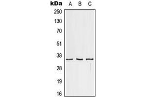 Western blot analysis of CD32c expression in HeLa (A), Raw264.