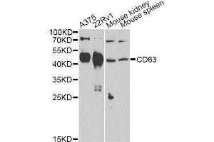 Western blot analysis of extracts of various cell lines, using CD63 Antibody. (CD63 antibody)
