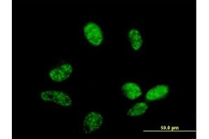 Immunofluorescence of purified MaxPab antibody to ZC3H14 on HeLa cell. (ZC3H14 antibody  (AA 1-306))